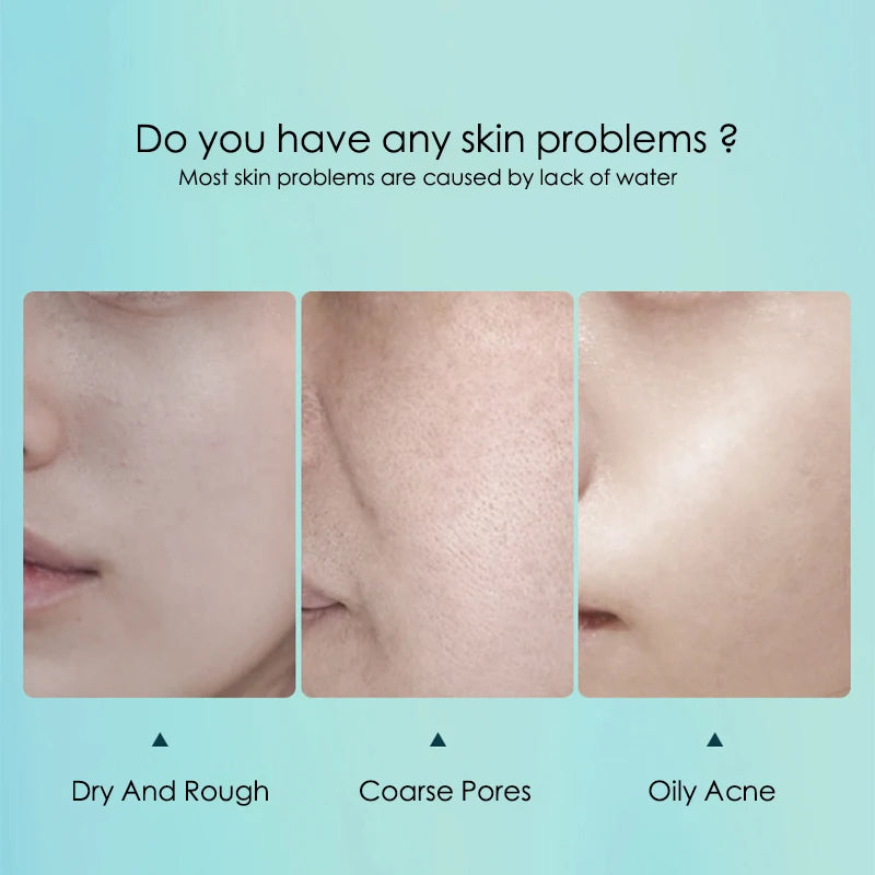 SADOER 20-Piece Snail Collagen & Hyaluronic Acid Sheet Mask Set - Korean Skincare