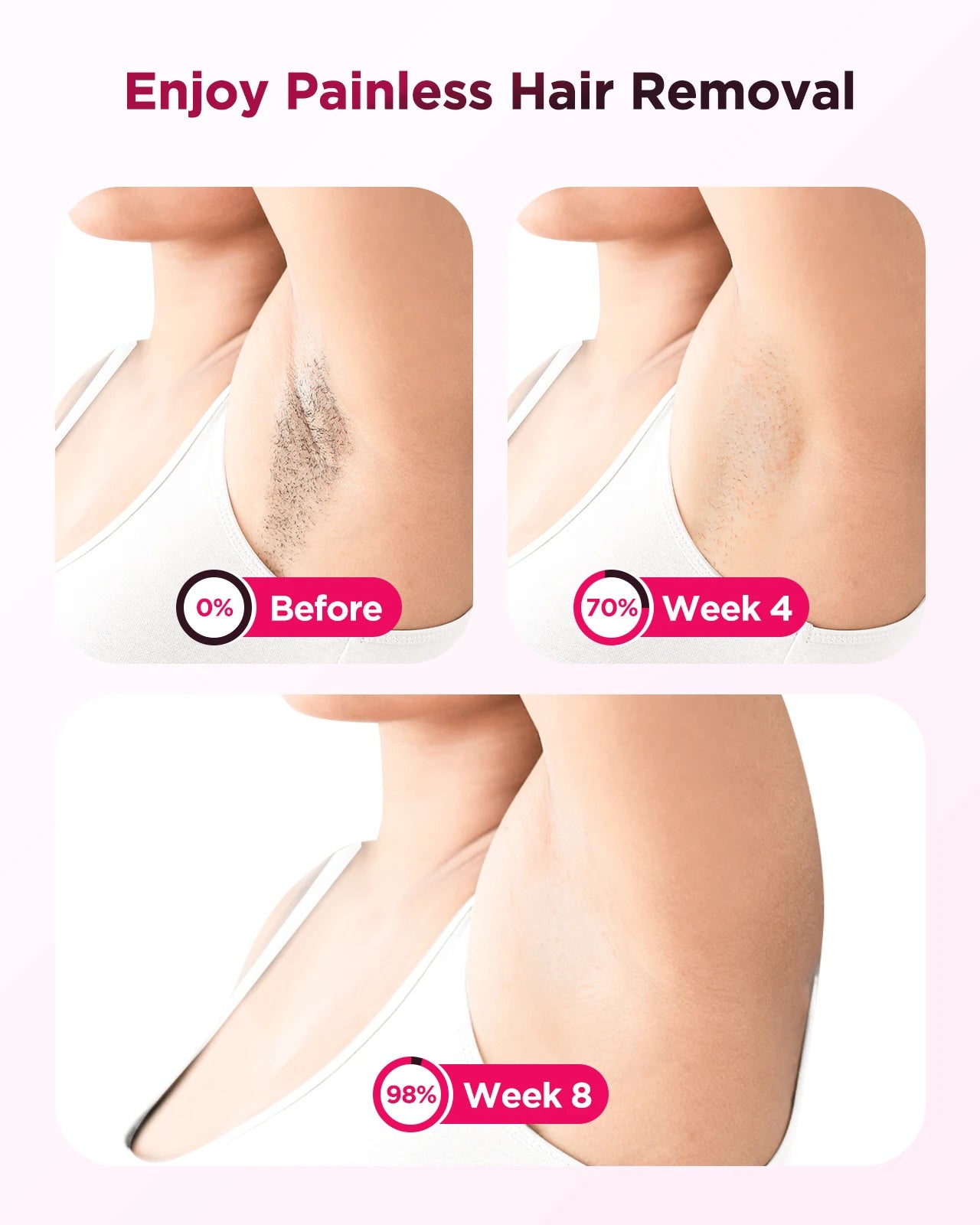 IPL Laser Hair Removal Device - Permanent & Painless for Men & Women