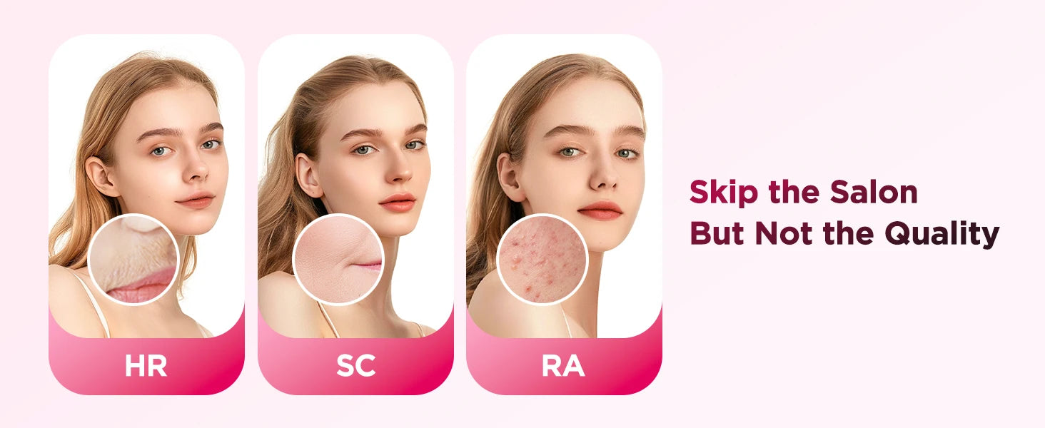 IPL Laser Hair Removal Device - Permanent & Painless for Men & Women
